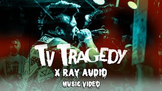 X RAY AUDIO